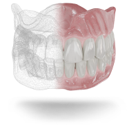 Dental Prosthesis